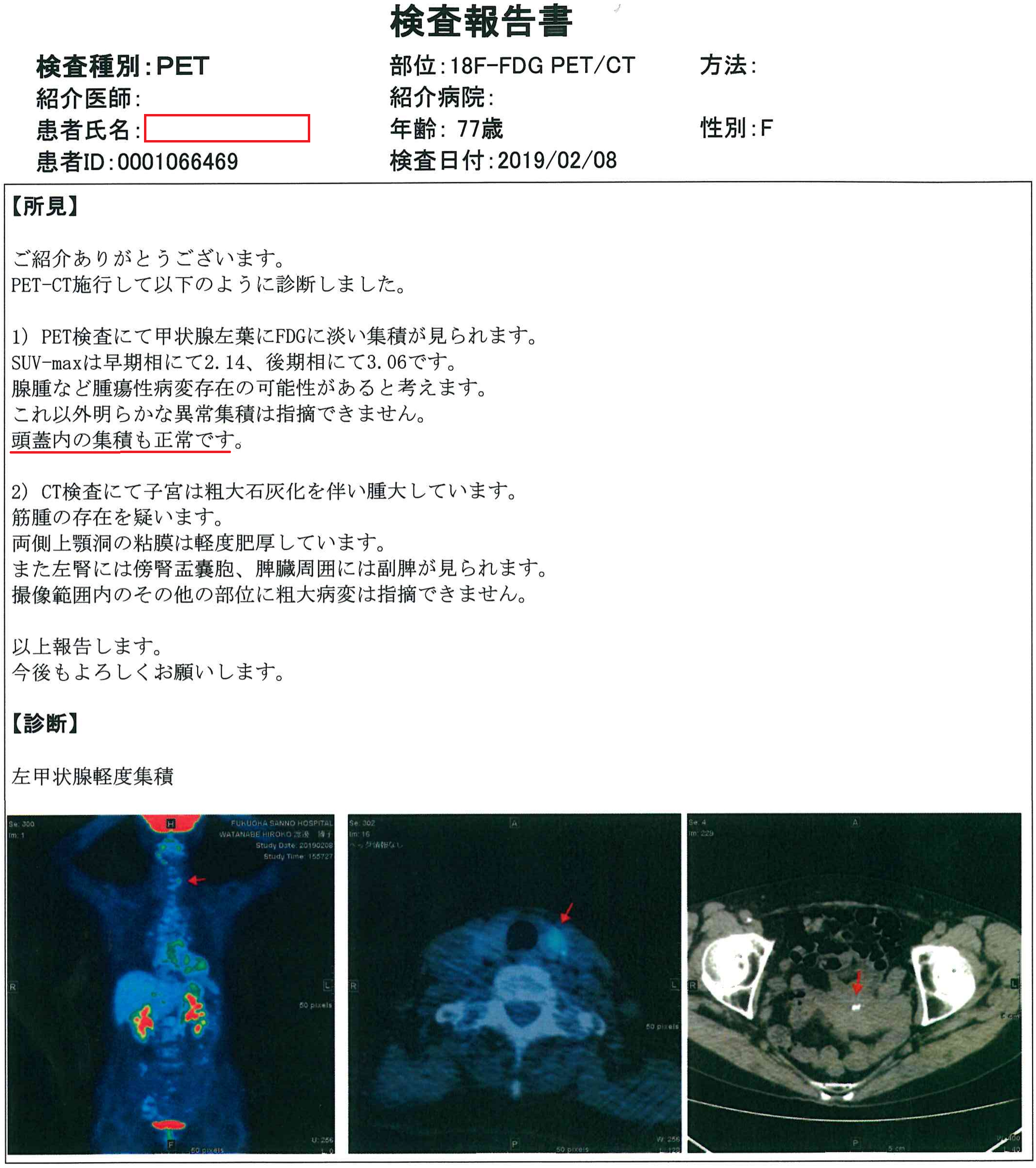 もうすぐ癌も治るようになりますよ！ | さくらクリニック博多 院長ブログ